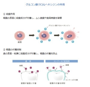 Logic：なぜ「殺菌」が長時間続くのか？
